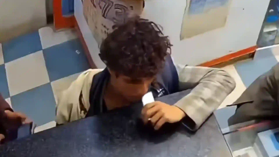 Joven muerde batería de celular y esta le explota en el rostro: el video se volvió viral